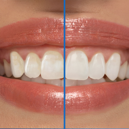 Pasta do zębów z fluorem mocno miętowa Arctic Fresh 3D White Crest 93 g