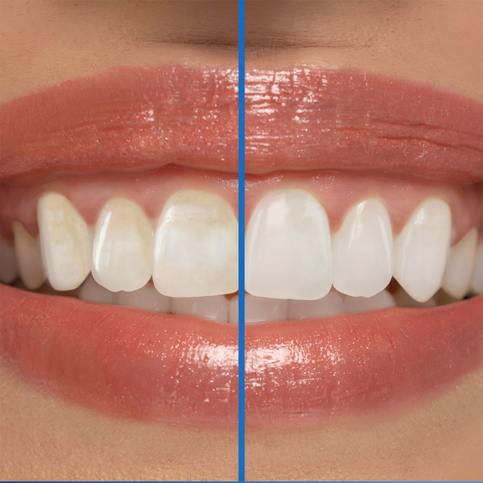 Pasta do zębów z fluorem mocno miętowa Arctic Fresh 3D White Crest 93 g